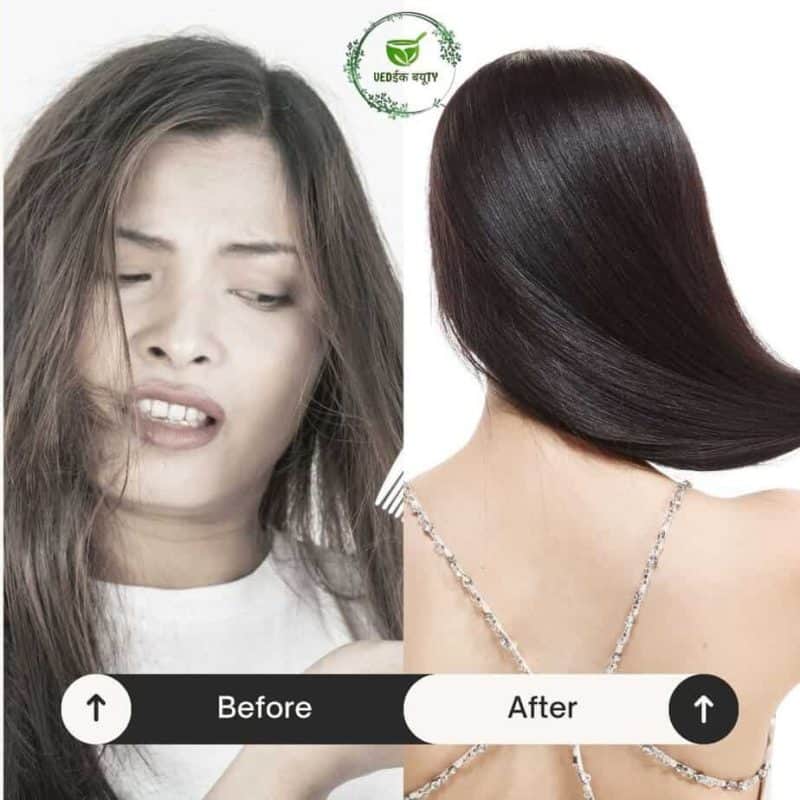 AWLA & ALOEVERA SHAMPOO 200gm - Image 4